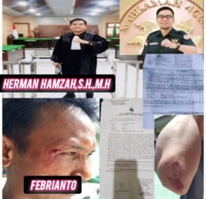 Istri pejabat di duga curi HP VIVO: Suami Korban Pemilik HP malah Dikeroyok & Dilempar Batu, HERMAN HAMZAH, S.H., M.H. Siap Kawal Hukum